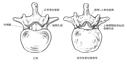 広告に投票する勃起不全の自由